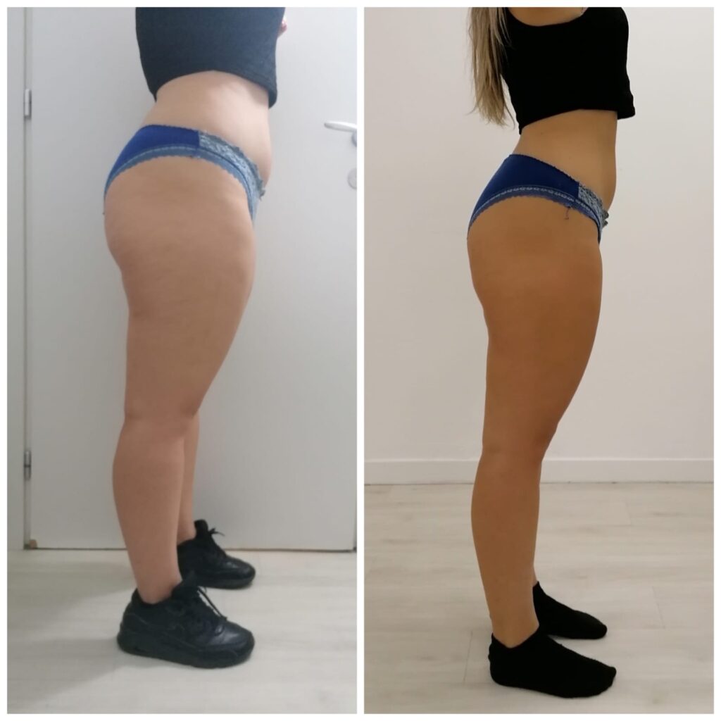 After 3 treatments