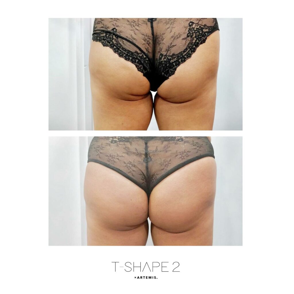 Glutes_1