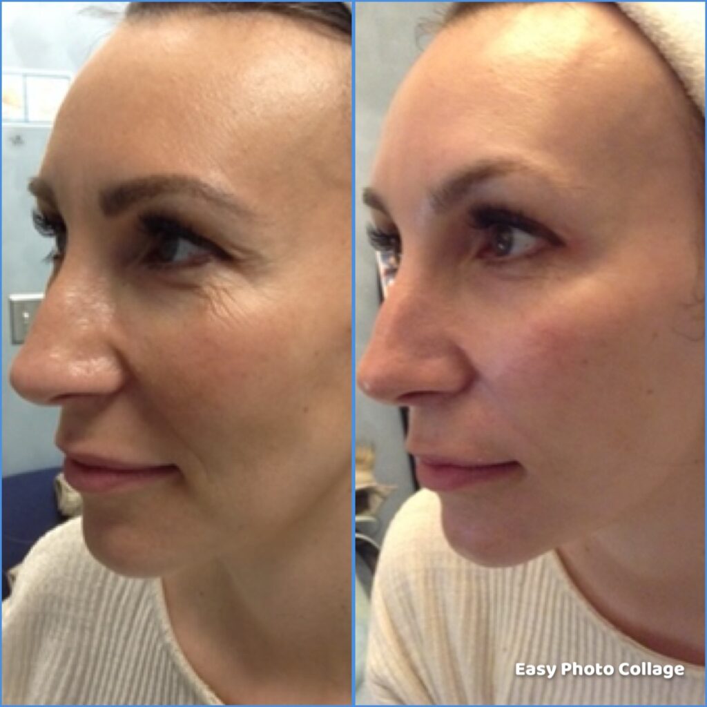 4 treatments (4)