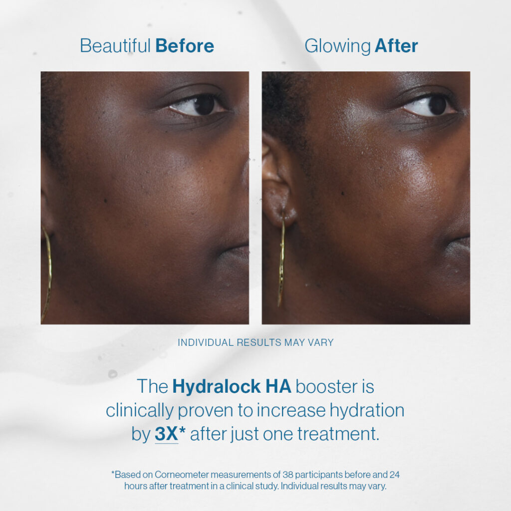 Before After Image 1_1