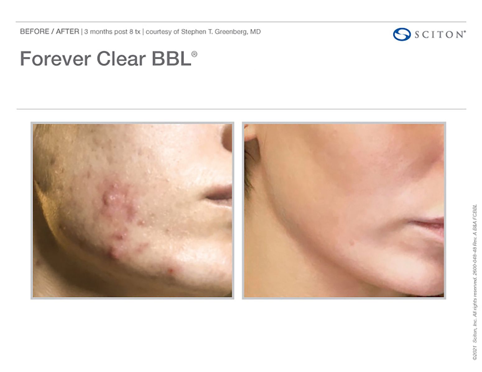 2600_048_48_Rev_A_B_A_Photos_Forever_Clear_binder_80c06d0b52