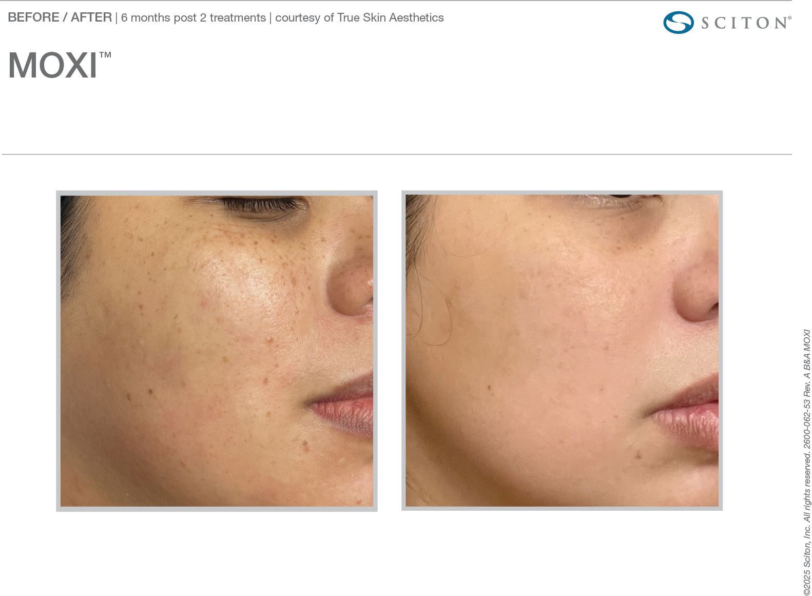 2600_062_53_Rev_A_B_A_Photo_MOXI_binder_6c9fde413a