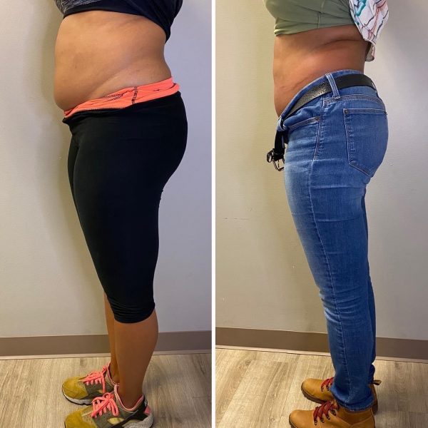 2 Shape, 3 Tone (side 1), US Cryotherapy