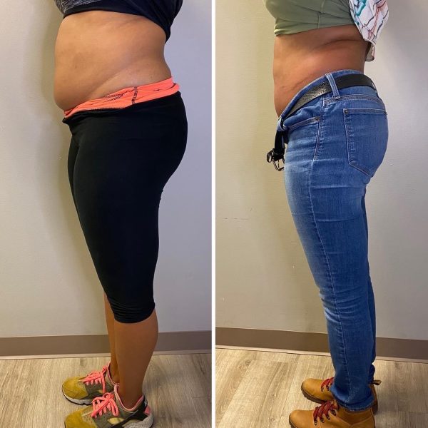 2 Shape, 3 Tone (side 1), US Cryotherapy