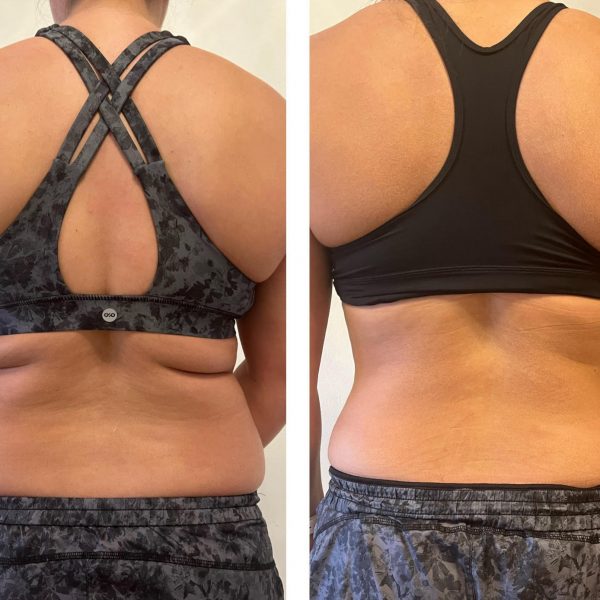 6 Shape, 3 Tone (back), Sculpt